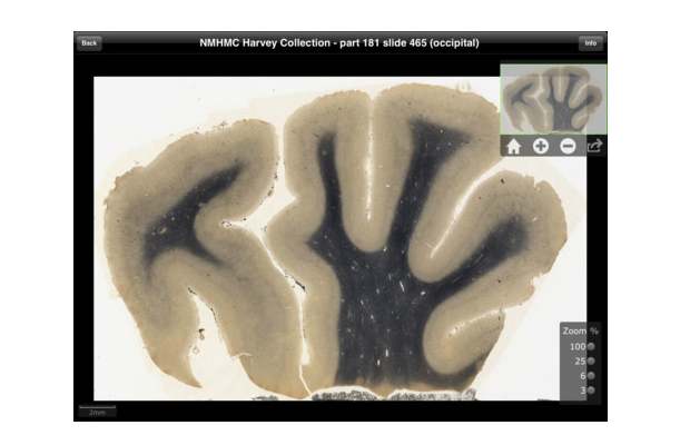 Access Albert Einstein's brain through iPad app